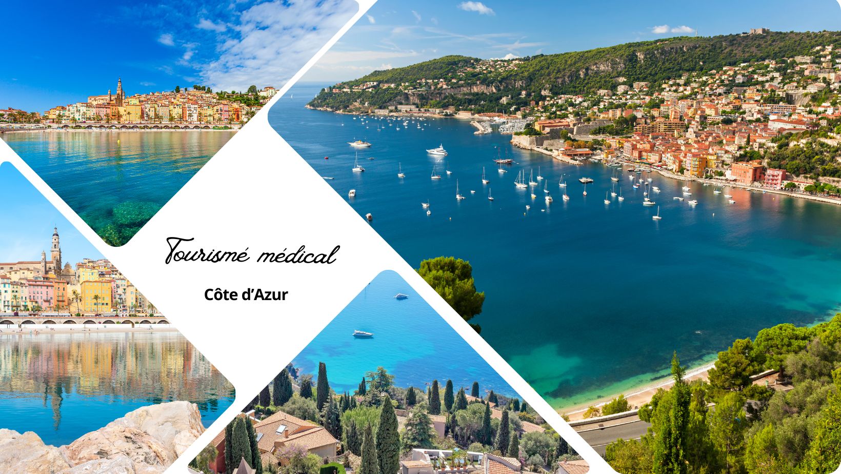 L'excellence du tourisme médical sur la Côte d'Azur : soins VIP et guérison méditerranéenne